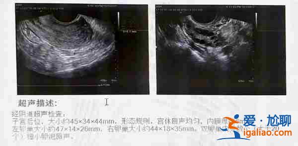 宁波代生孩子，90后妈妈的视角？