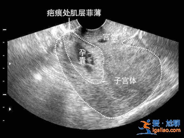 乌鲁木齐代生宝宝？