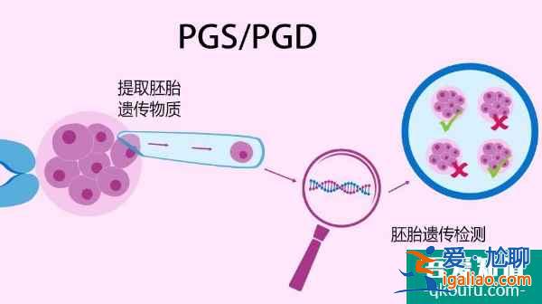 先天性输精管缺如，去泰国做试管婴儿如何成就“爸”业？？