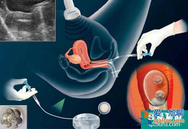 通过试管婴儿生健康宝宝的基础之良好子宫内环境？