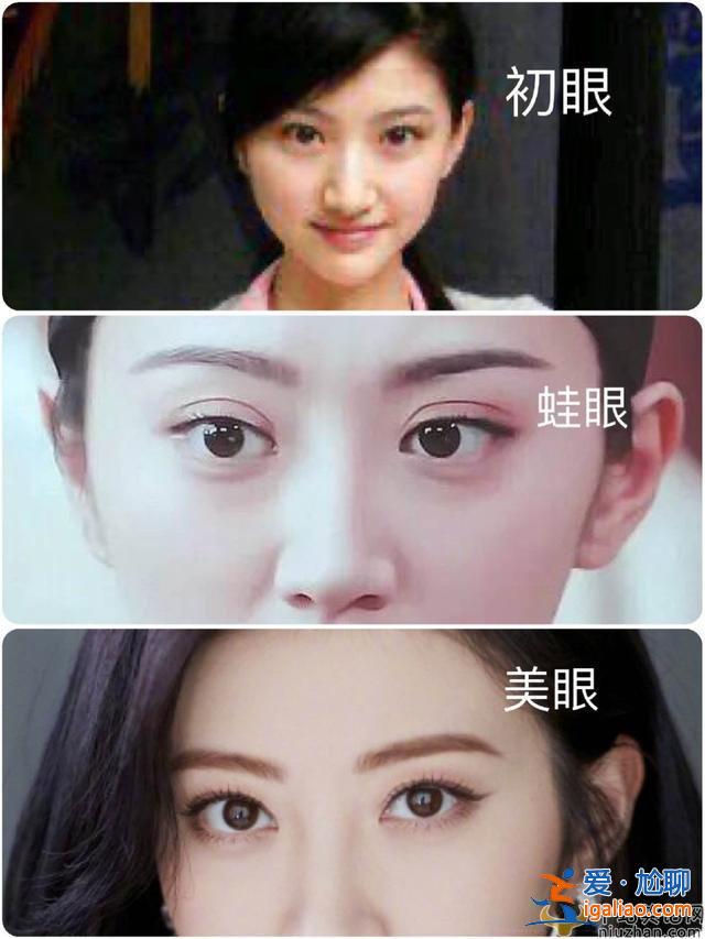 盘点那些整容的女明星 有的美若天仙台 有人脸僵如石