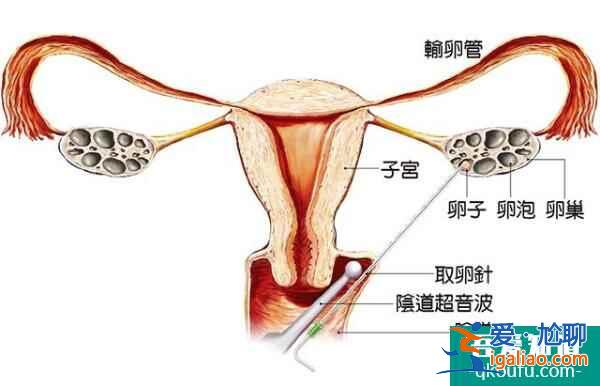 试管婴儿周期中有哪些注意事项？？