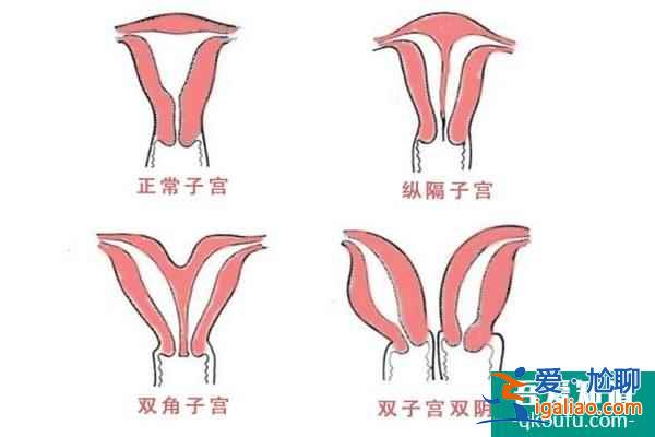 深析三个子宫异常问题？