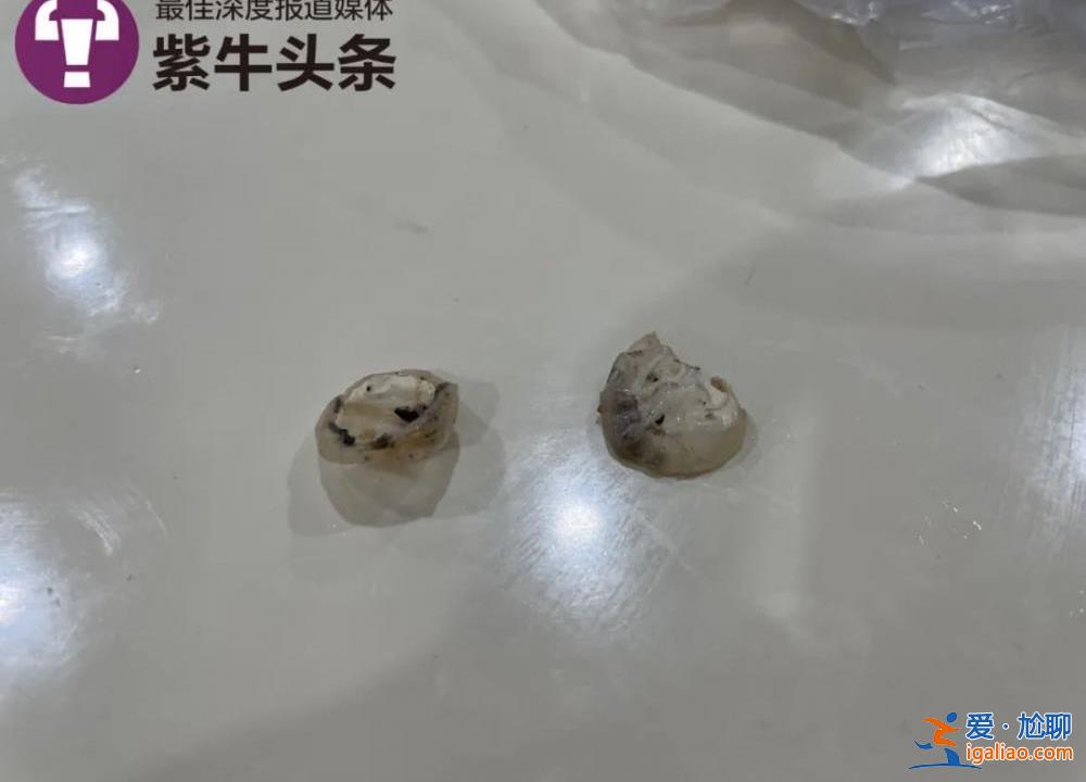 食堂饭菜异物是鸭子眼球巩膜？现场实测鸭眼球巩膜比鸭眼外表大数倍？