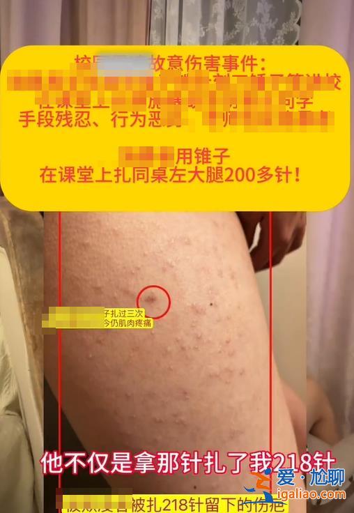 山东章丘一女生被同桌男生用锥子扎数百下？当地已成立联合调查组？